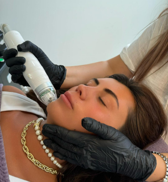 radiofréquence fractionnée (rf)