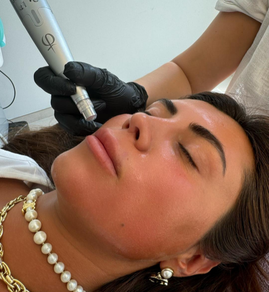 phiion pro plasma lift